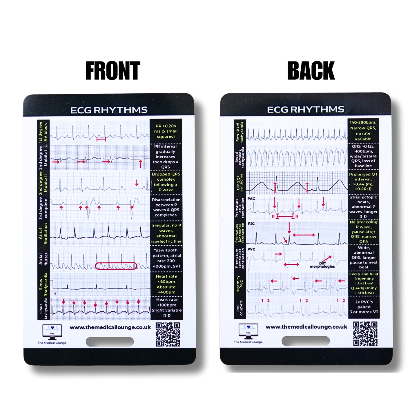 ECG Rhythm Reference Card | 15 Abnormal ECG Strips with Visual Guide and Criteria | Pocket Card for Paramedics, Nurses and Students