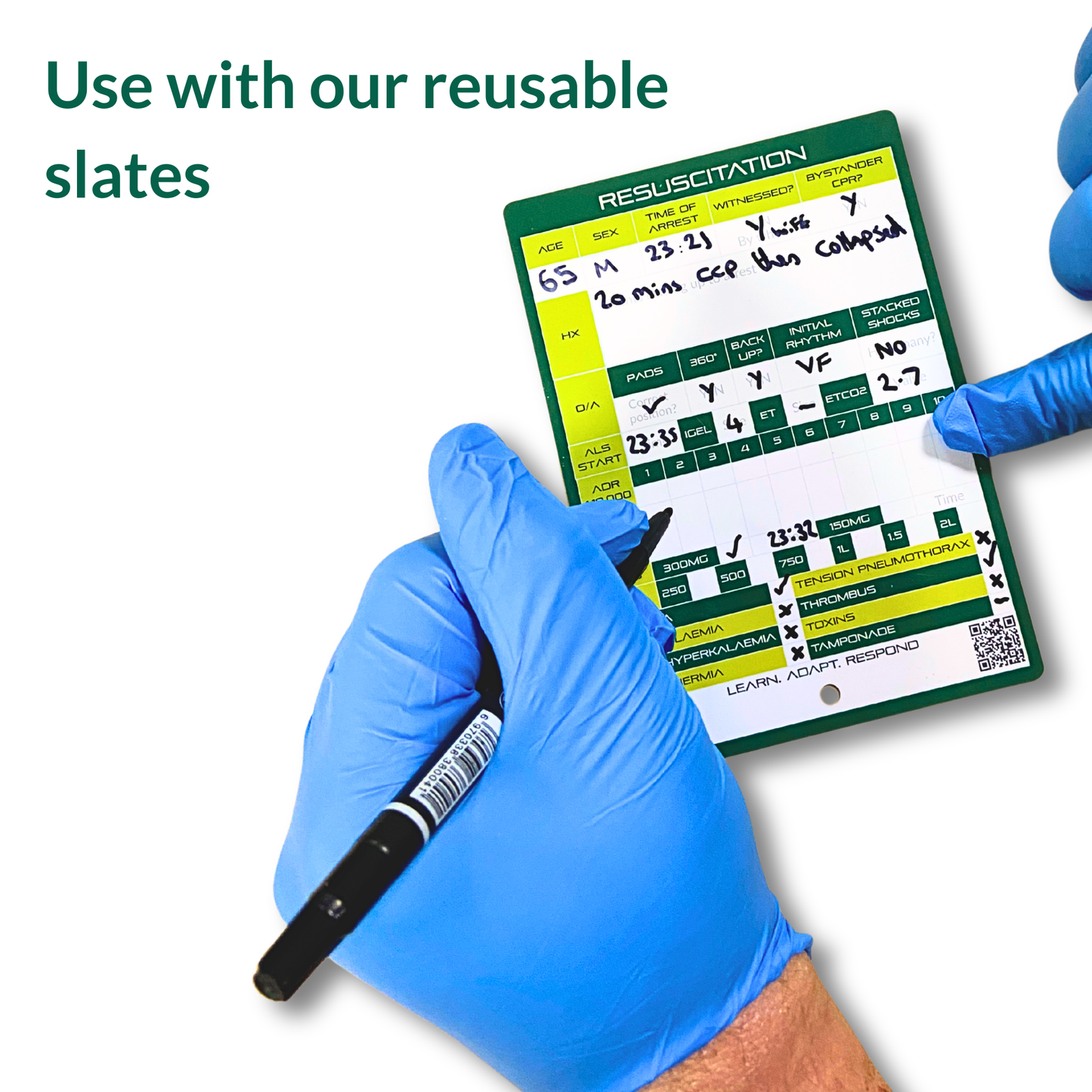 Black Wipe-Clean Marker Pen | Dual Tip Fine + Chisel | Non-Permanent Black Ink | Reusable Board Marker | Bundle Add-On