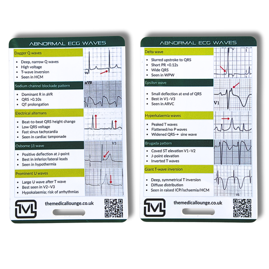 Abnormal ECG Waves Reference Card | ECG Study & Revision Aid for Pattern Recognition | Lanyard Reference Card For Paramedics, Nurses & Doctors