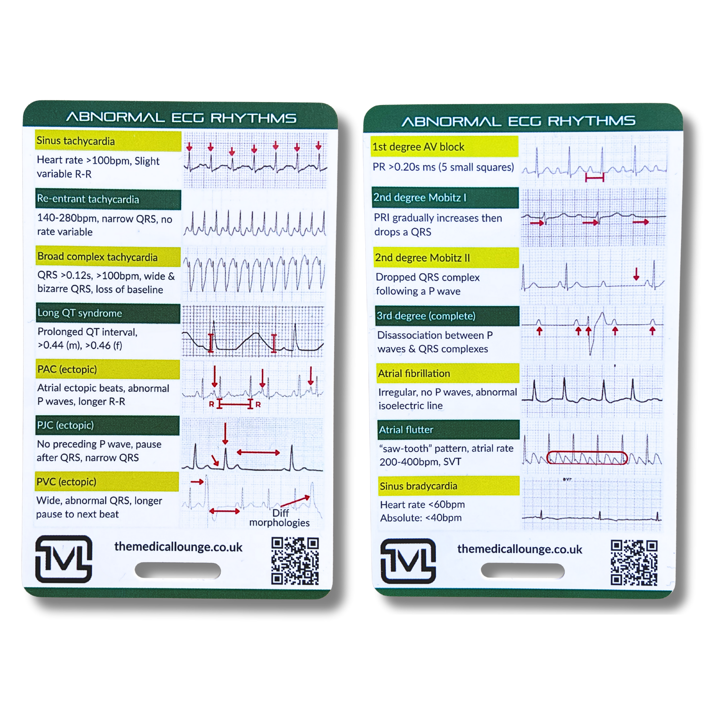 Abnormal ECG Rhythms – Interpretation Reference Card
