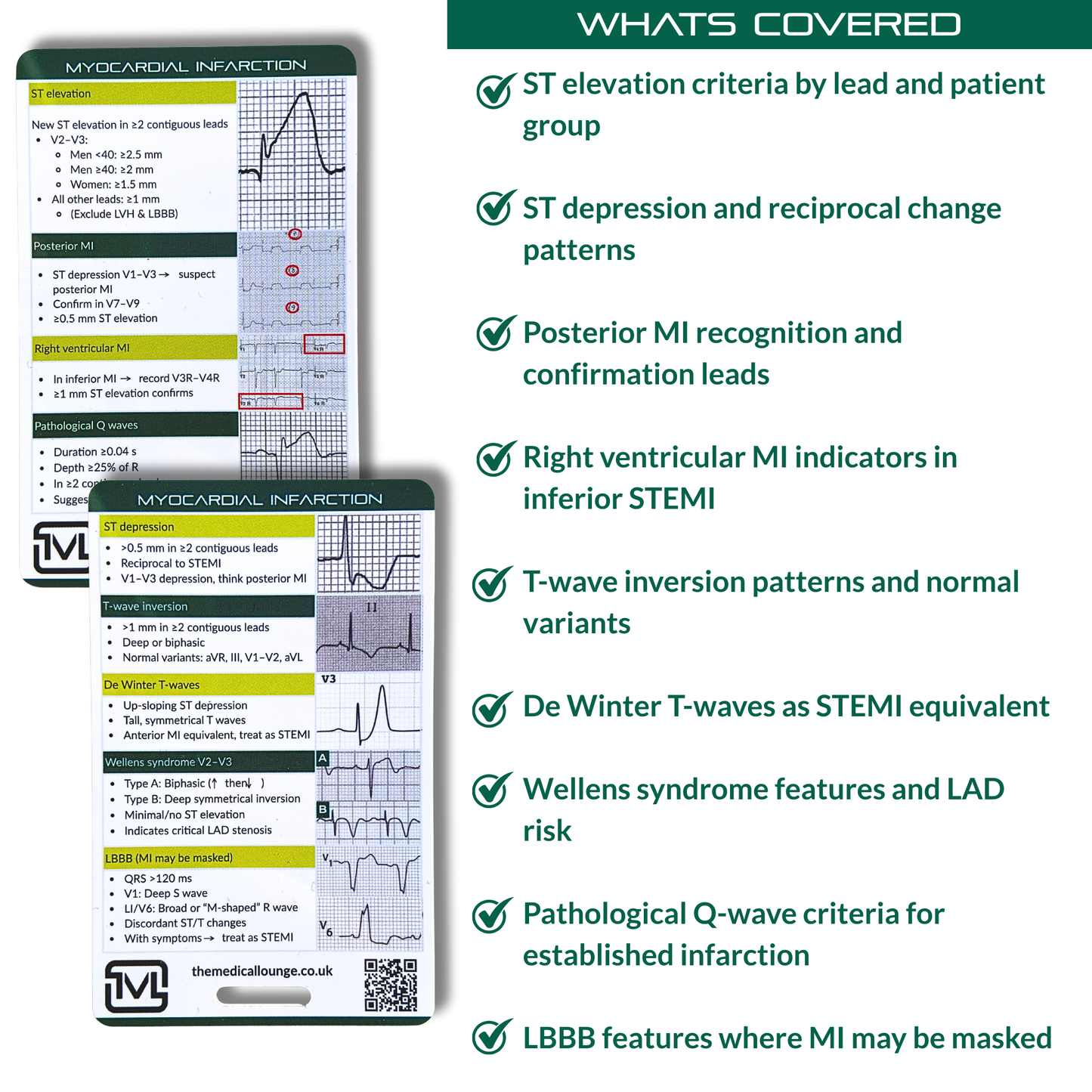 Myocardial Infarction ECG Reference Card | ECG Study & Revision Aid for STEMI Patterns