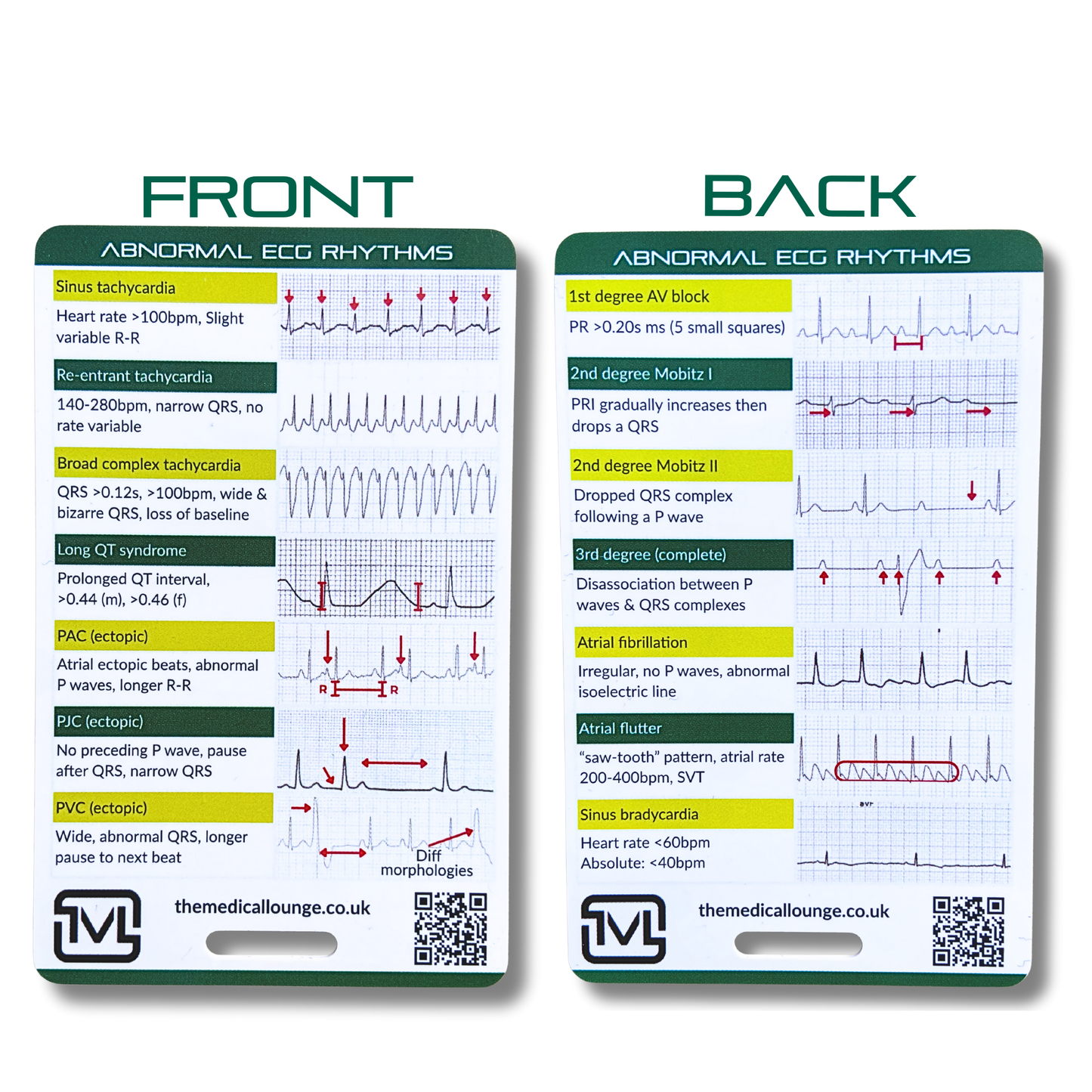 Abnormal ECG Rhythms – Interpretation Reference Card