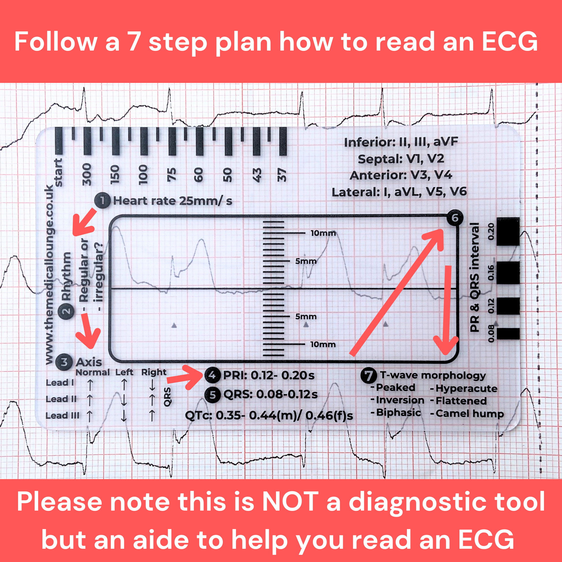 ecg-ruler-the-medical-lounge-store