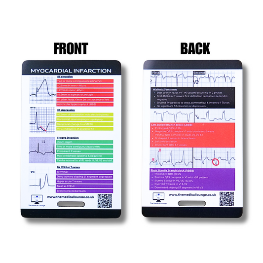 Myocardial Infarction ECG Reference Card | 7 Wave Abnormalities with Criteria and Descriptions | Lanyard Card for Paramedics and nurses