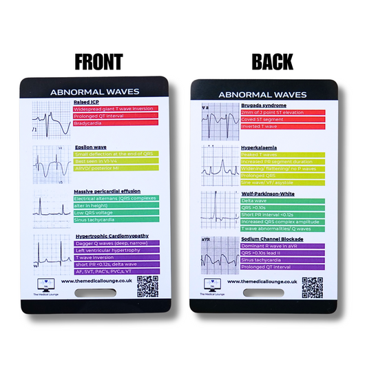 Abnormal ECG Wave Reference Card | 8 Rare ECG Patterns with Visual Descriptions | Pocket Guide for Paramedics, nurses and ECG Students