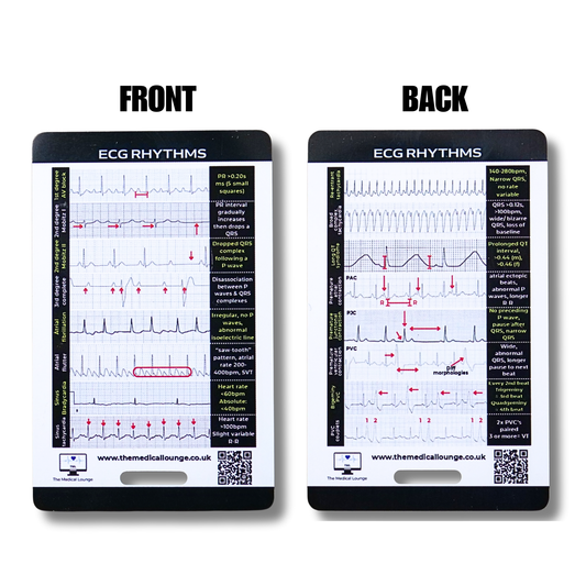 ECG Rhythm Reference Card | 15 Abnormal ECG Strips with Visual Guide and Criteria | Pocket Card for Paramedics, Nurses and Students